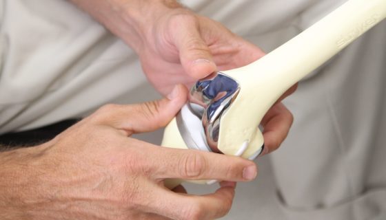 Innovative Orthopedics